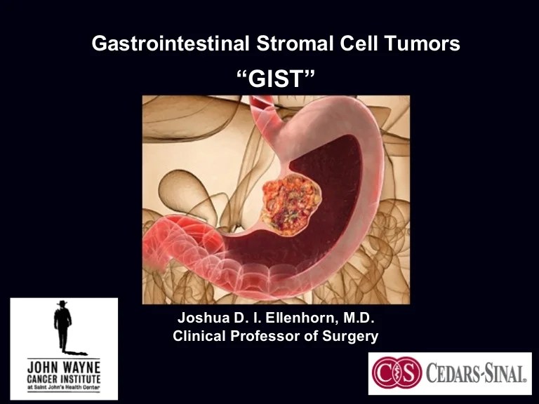 The Gist of GIST