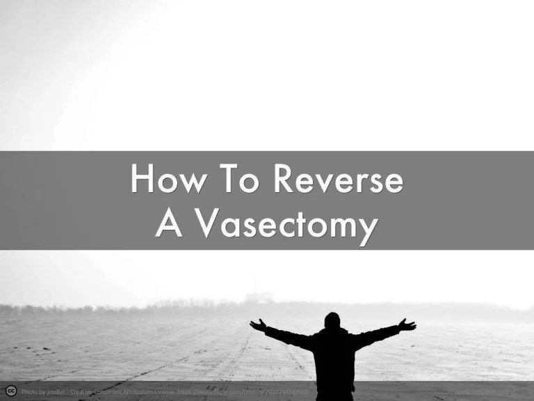 How ToReverseAVasectomy