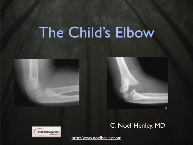 Pediatric Elbow Examination and Xrays