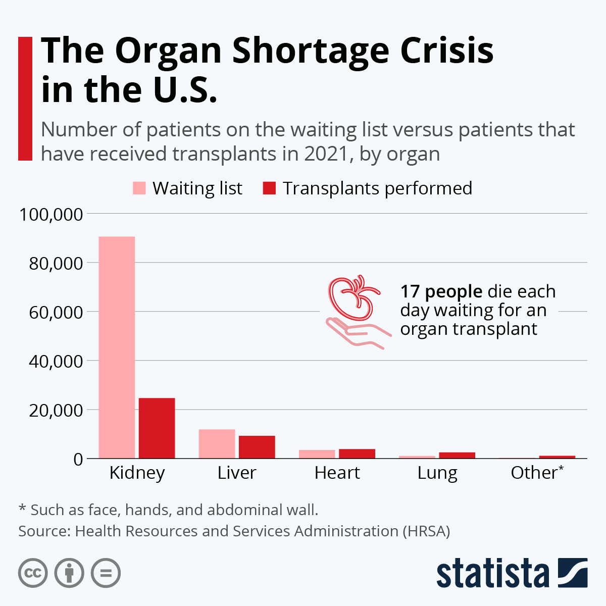 Chart The Organ Shortage Crisis in the U.S. Statista