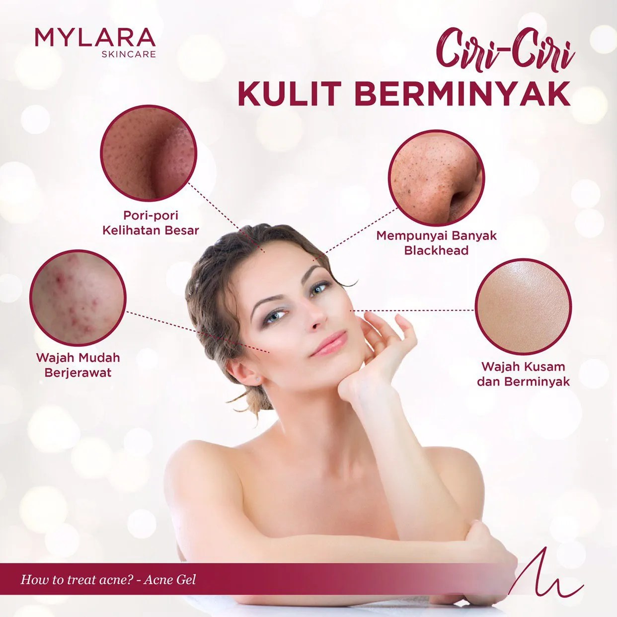 CIRICIRI KULIT BERMINYAK! MYLARA Skincare
