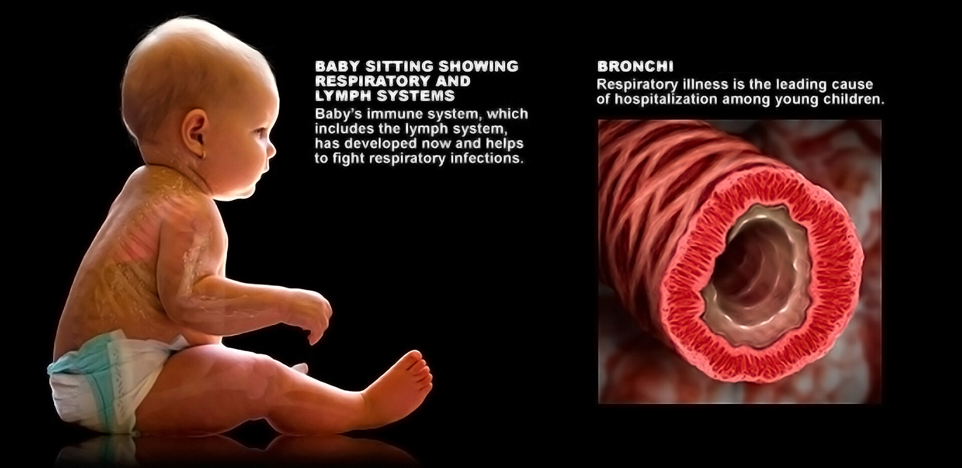 What Are the Types of Newborn Breathing Conditions? StoryMD