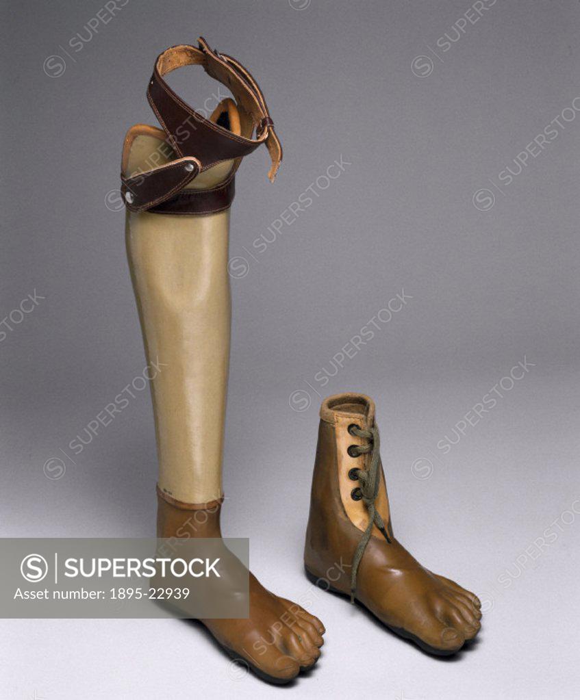 Below knee artificial leg, with Jaipur foot, (left), and Jaipur