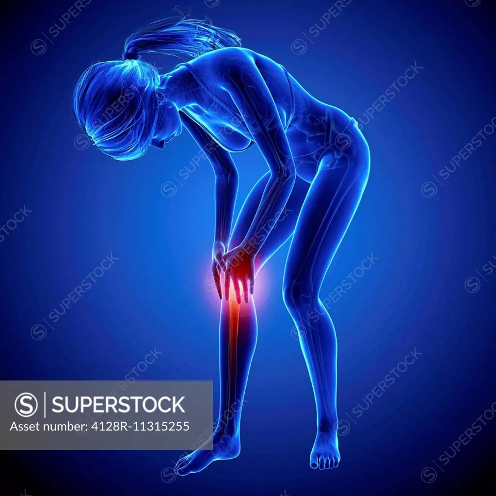 Knee pain, computer artwork. SuperStock
