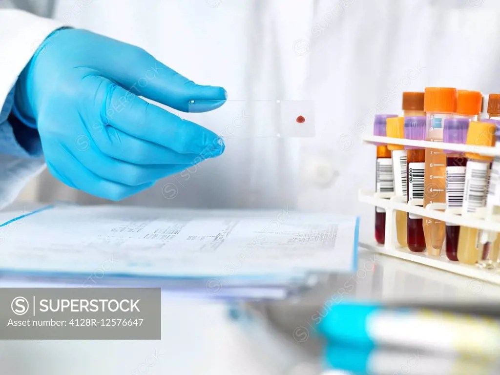 Human samples for analytical testing. SuperStock