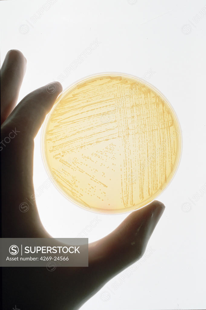 Bacteriology. Culture of Grampositive Staphylococcus aureus in Petri