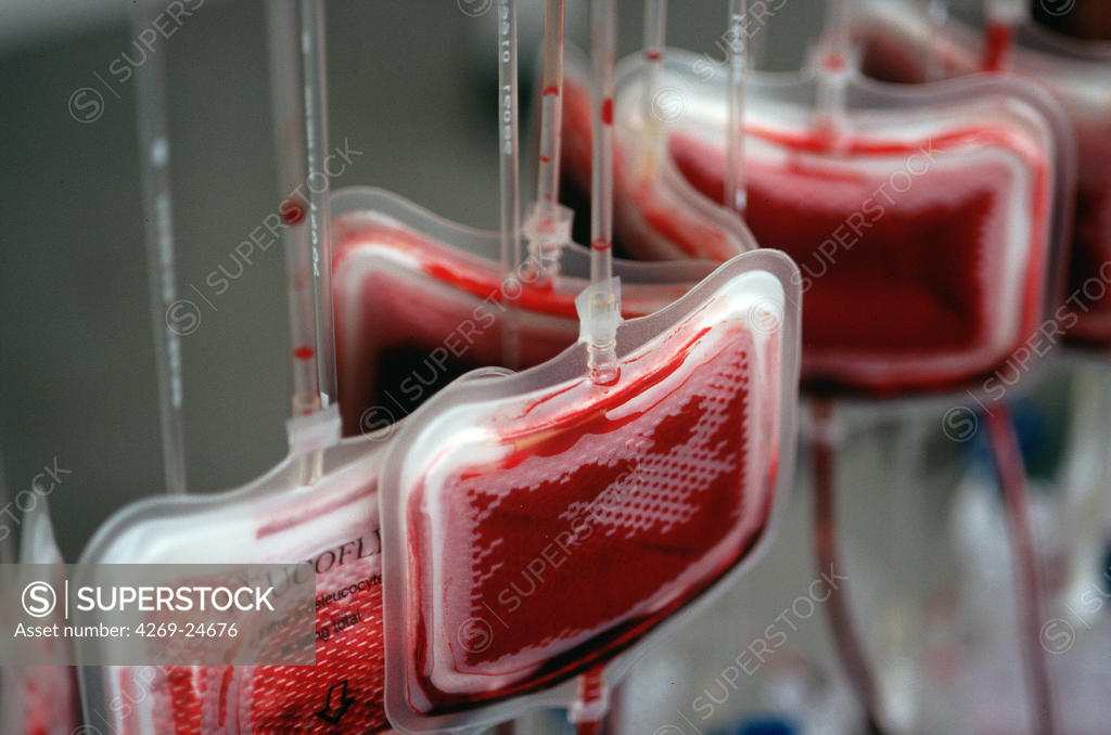 Blood transfusion. Blood filtration in a Blood transfusion center the