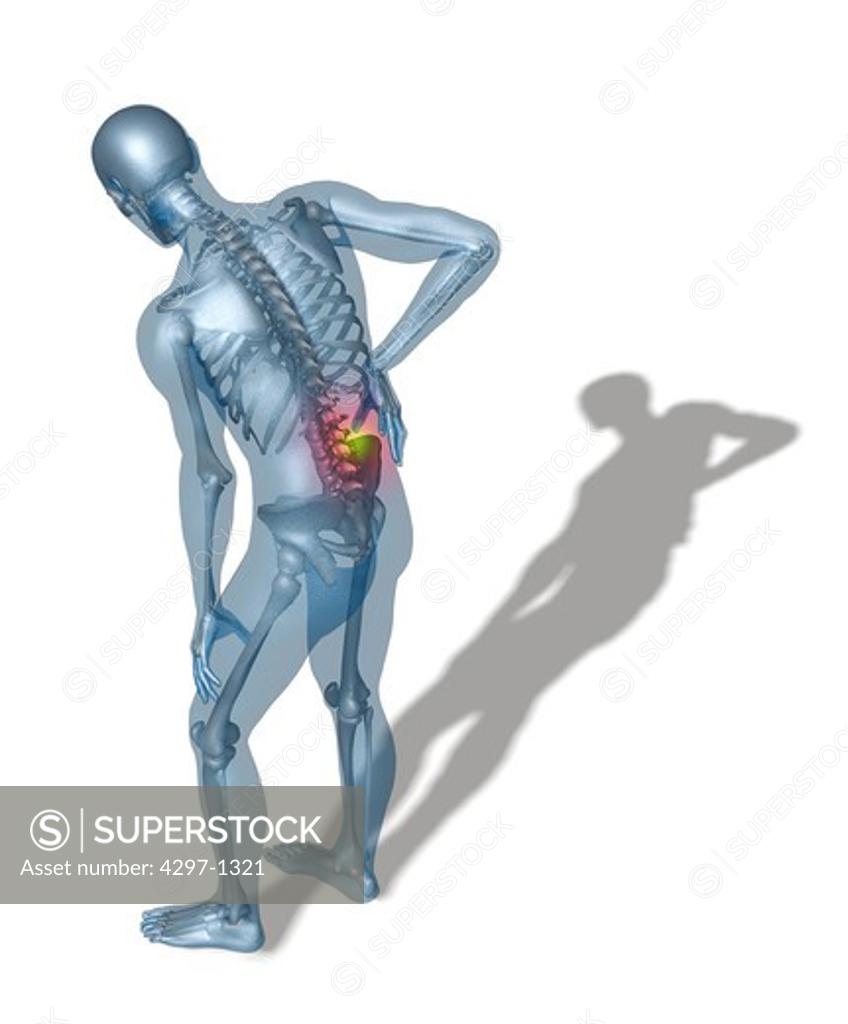 A man hunched over holding his back, in pain SuperStock