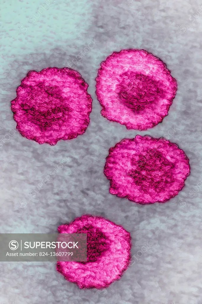 Varicella zoster virus (VZV or HHV 3). Image taken with transmission