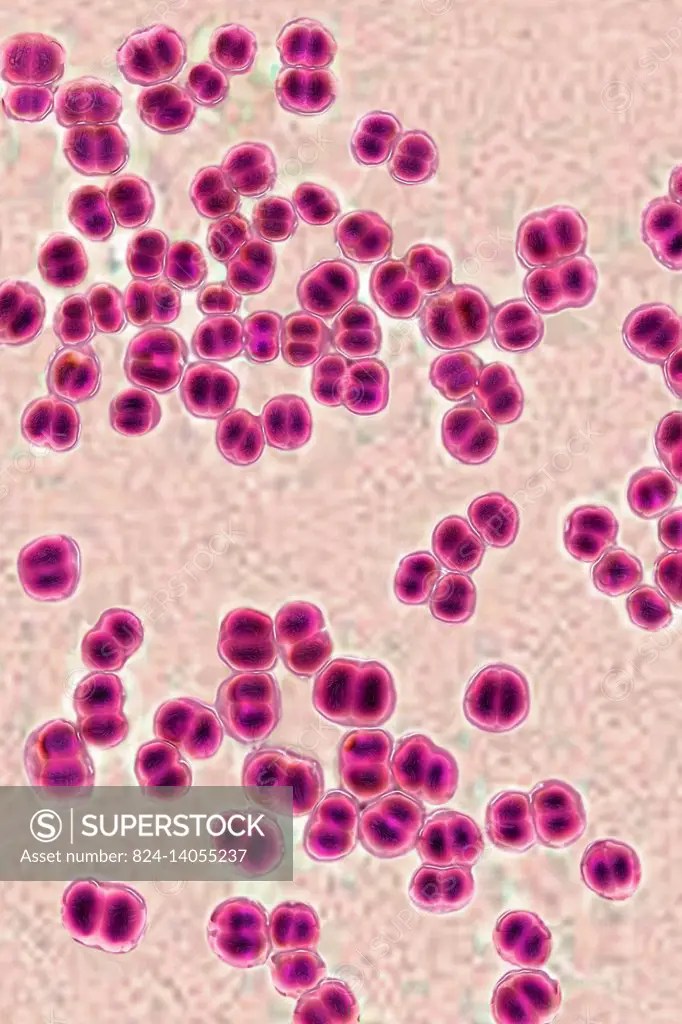 Meningococci (Neisseria Meningitidis), the bacteria in meningitis. Seen