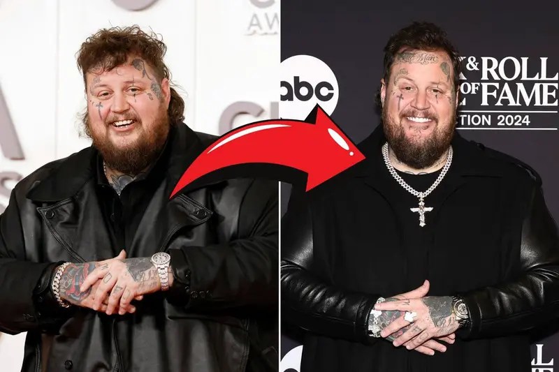 Massive Jelly Roll weight loss before and after results leave the(09)