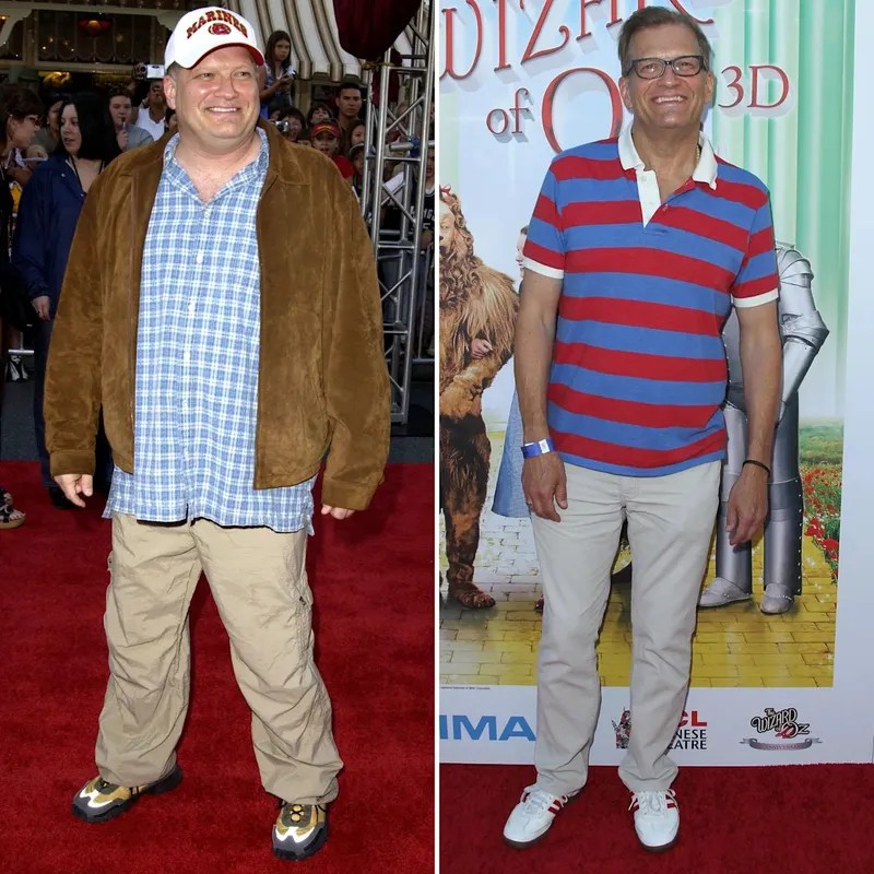 Drew Carey's Weight Loss Red Light Therapy Before & After Cellulite