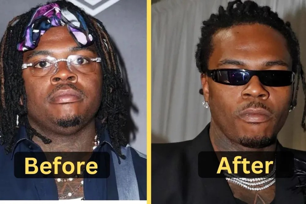 Gunna Weight Loss A Timeline of the Rapper's Physical Transformation