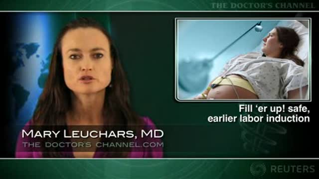 Labor induction more effective with Foley balloon inflated to 60mL