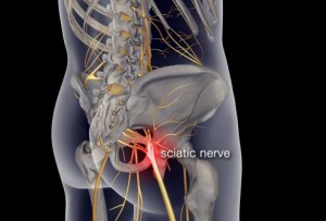 This website uses cookies to improve your experience while you navigate through the website. How Massage Therapy And Chiropractic Can Relieve Sciatica ...