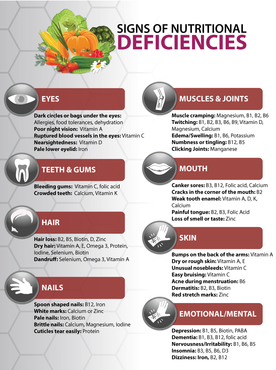 Do you have a Nutritional Deficiency? Rutherford, NJ Wellness One