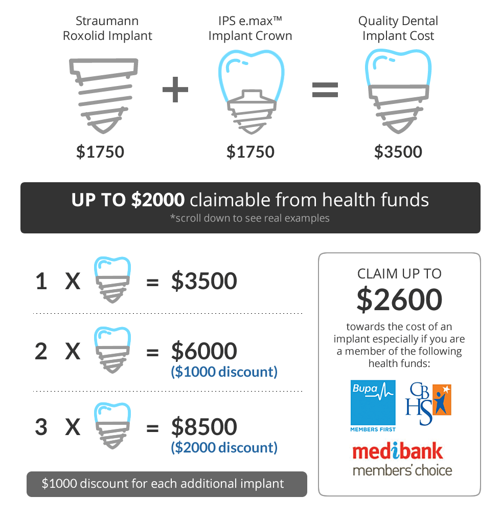 Dental Implant Cost Epping Family Dental