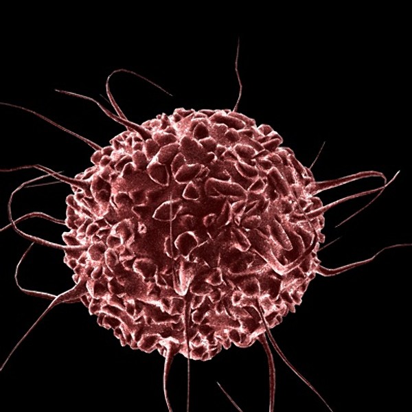 Scientists Find A Better Way To Fight Cancer