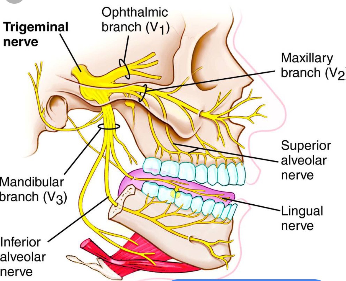 Dental Implant and nerve damage lawyers