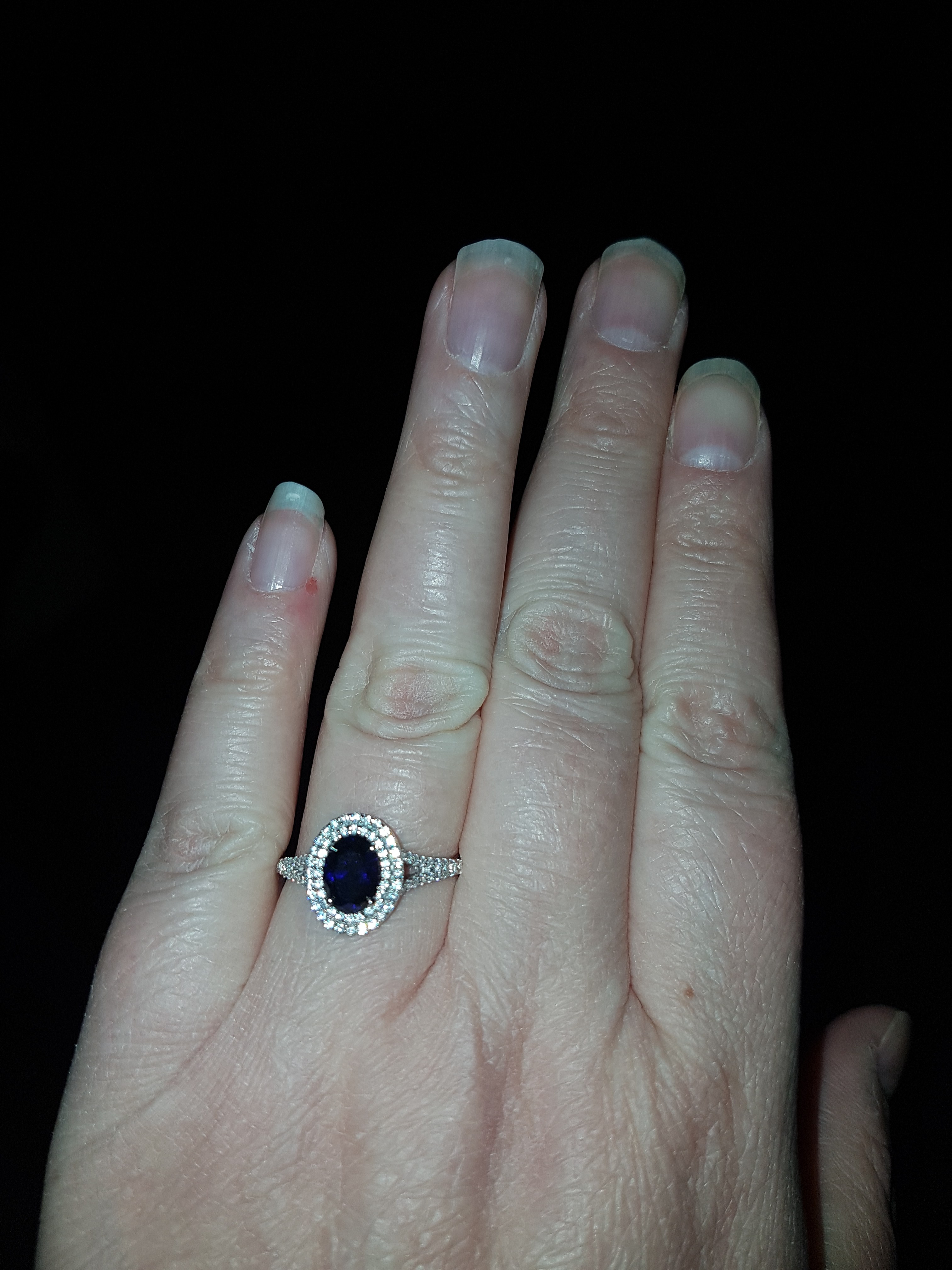 Lets talk rings and pregnancy!