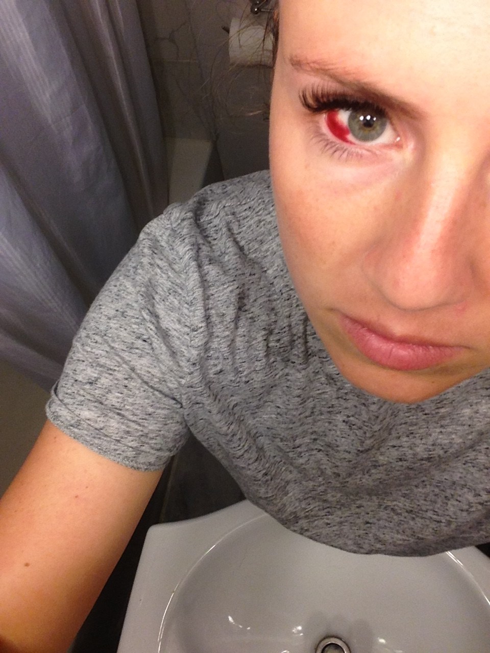 ** WARNING GRAPHIC** Popped a blood vessel in my eye and wedding is