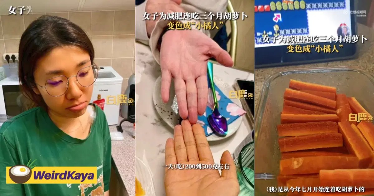 Woman's Skin Turns Orange After She Ate Carrots For 3 Months To Lose