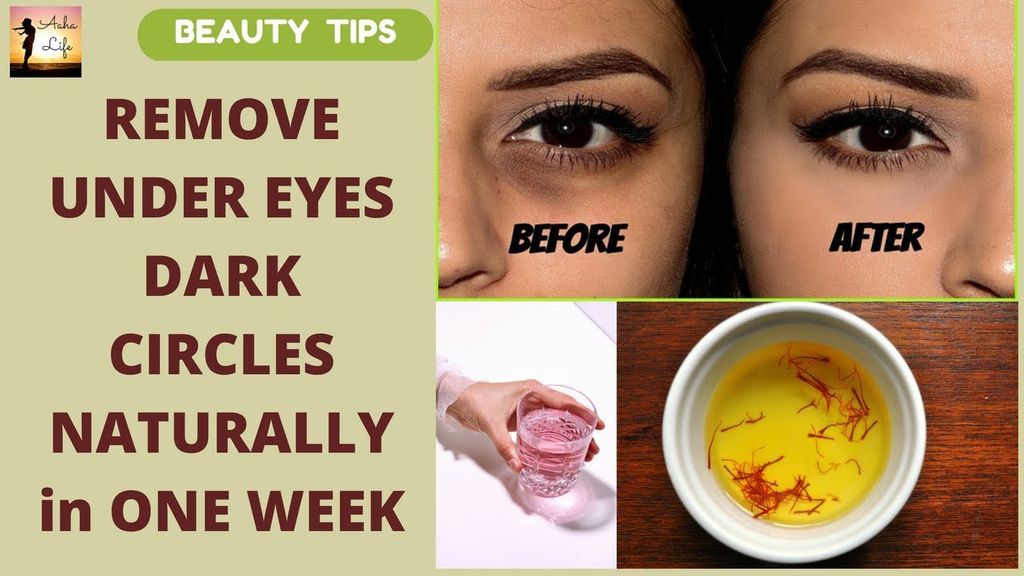 Ways To Remove Your Dark Circles Wrytin