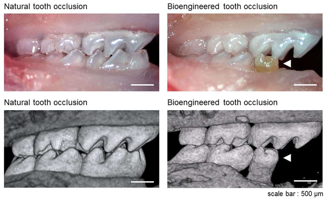 Scientists grow new teeth from stem cells
