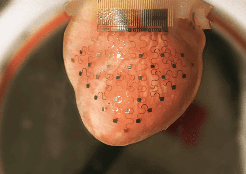 'Heartglove' fitted with stretchy electronics may replace pacemakers