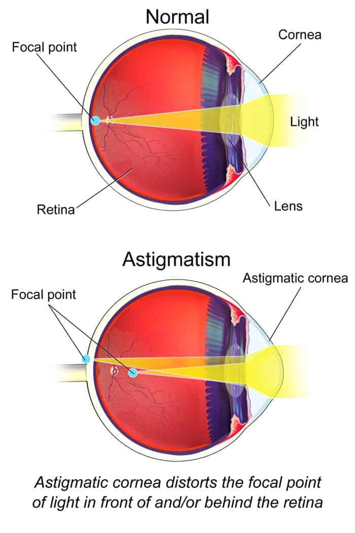This viral image is making people realize they have astigmatism