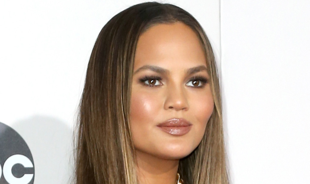 Chrissy Teigen Shares Photo of Her Stretch Marks Chrissy Teigen