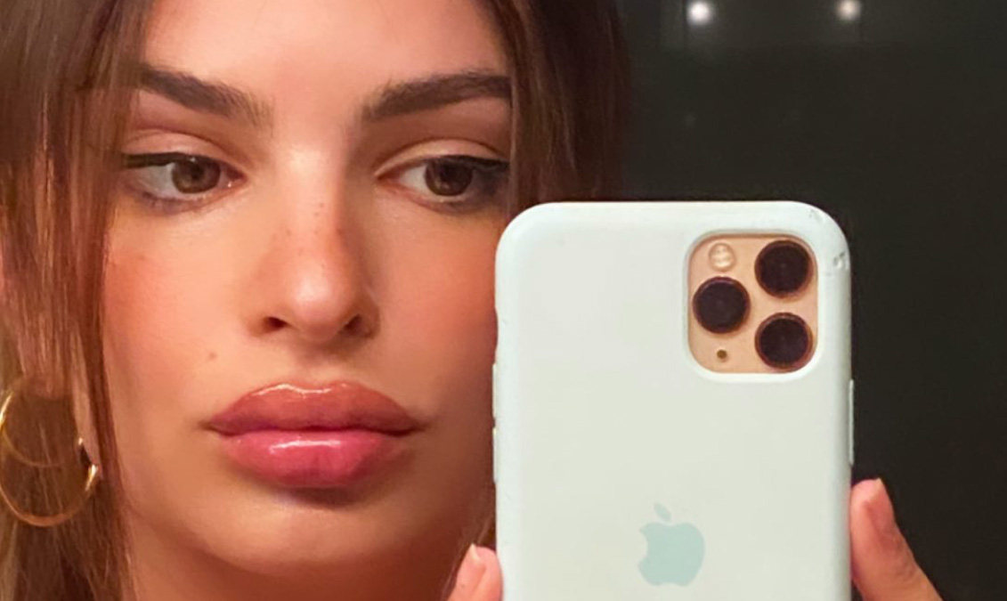 Emily Ratajkowski Slams Claims That She’s Getting Lip Injections While
