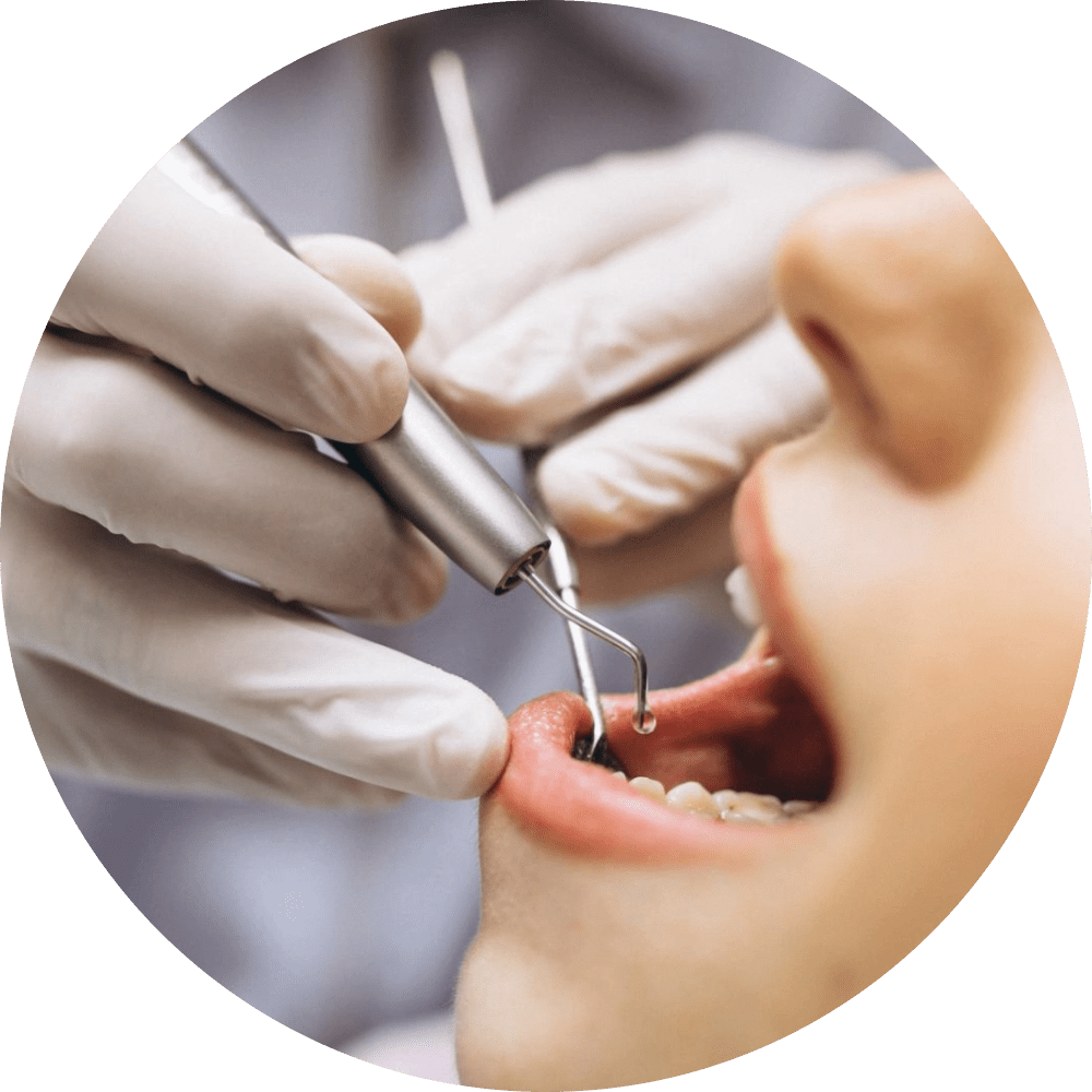 Klinik Pergigian LH Chong Open Daily Dental Clinic Penang, Teeth Whitening Bukit Mertajam