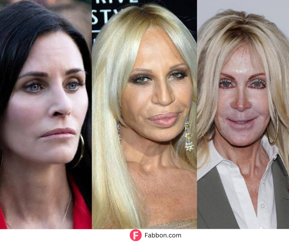 When Plastic Surgery Goes Wrong Lessons from 21 Celebrity Disasters