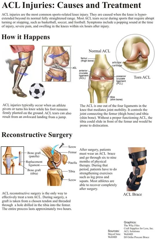 Sports Medicine — ACL Tears FishDuck