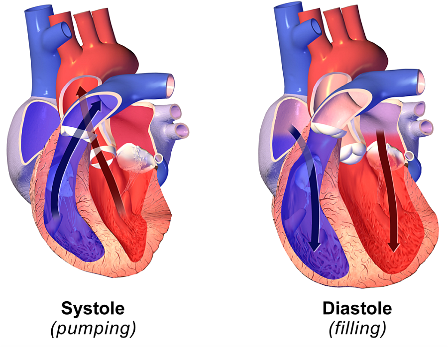 diastolic heart failure Heart Valve Replacement Forums