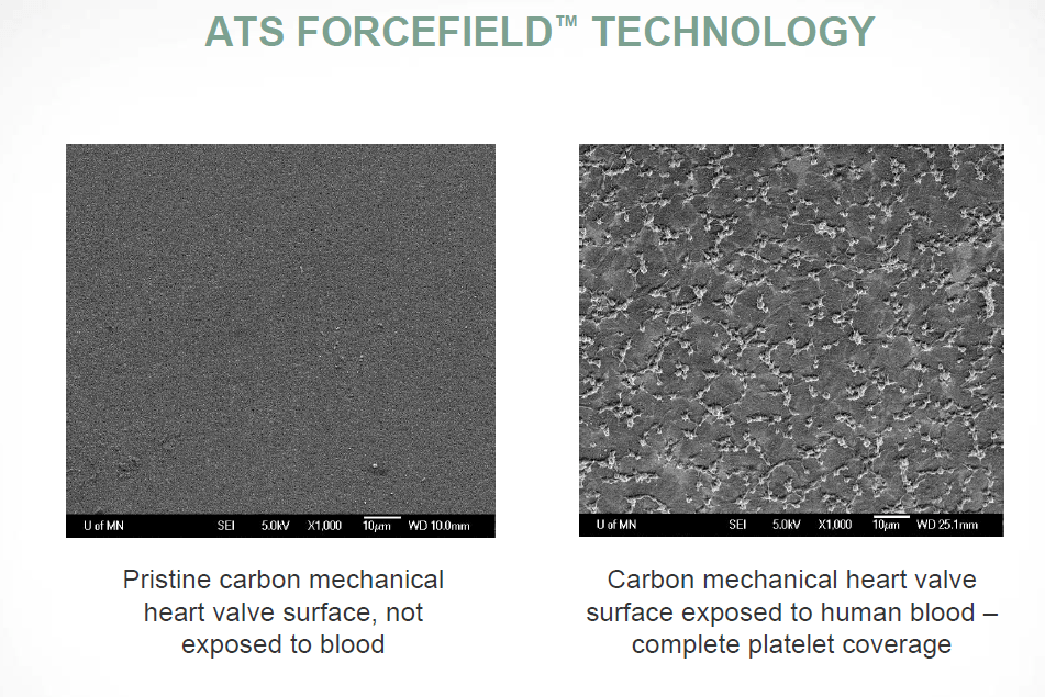 Aspirin metaanalysis study (focus on bleeds and cancer) Heart Valve Replacement Forums
