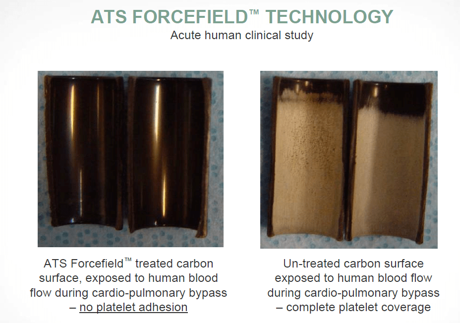 Aspirin metaanalysis study (focus on bleeds and cancer) Heart Valve Replacement Forums