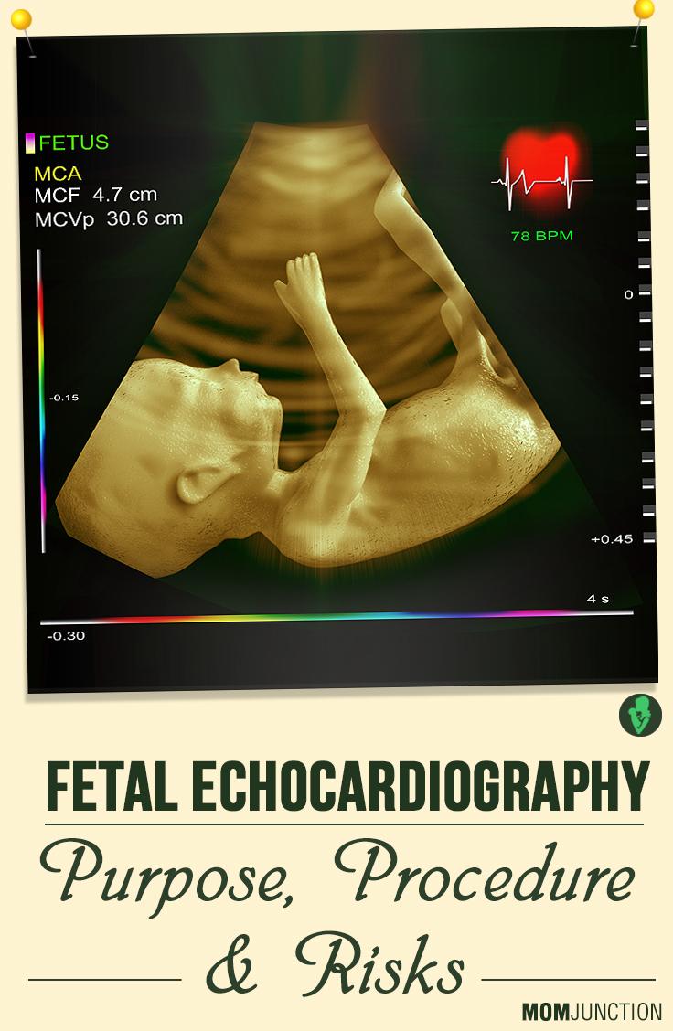What Is Fetal Echocardiogram And Why Is It Done?