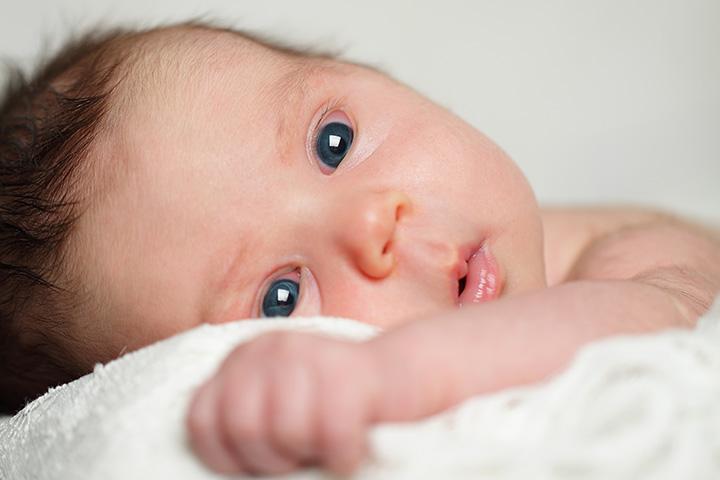 Swollen Eyes Infant Astigmatism Swollen Eyes Disease
