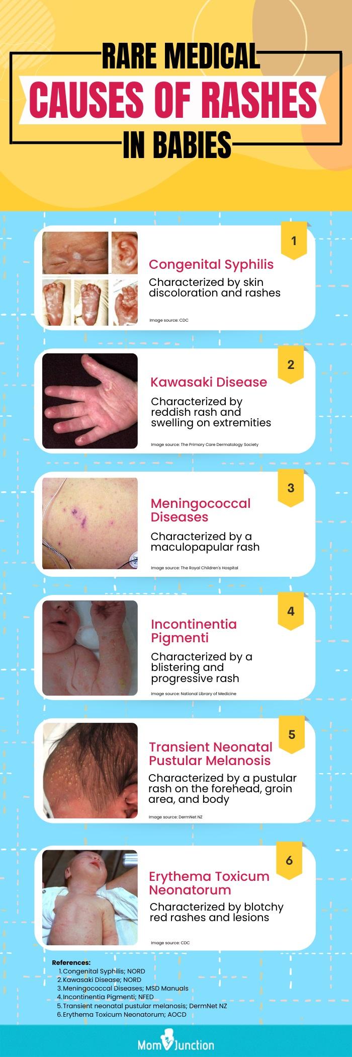 22 Different Causes Of Rashes In Babies And Their Prevention