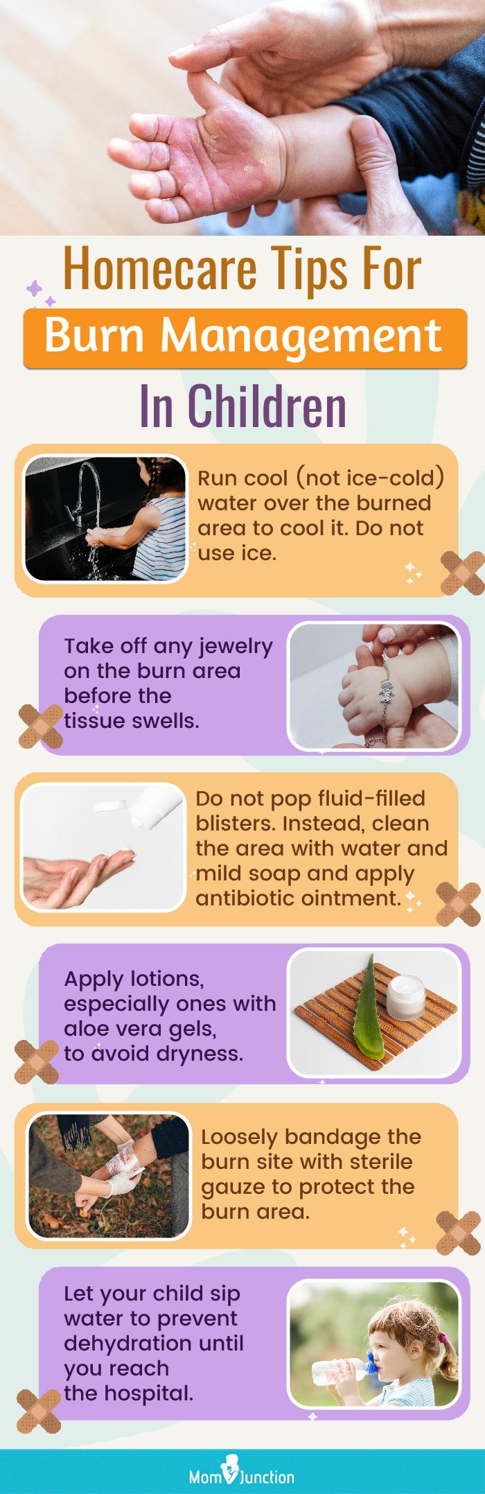 Burns In Children Treatment And Home Remedies MomJunction