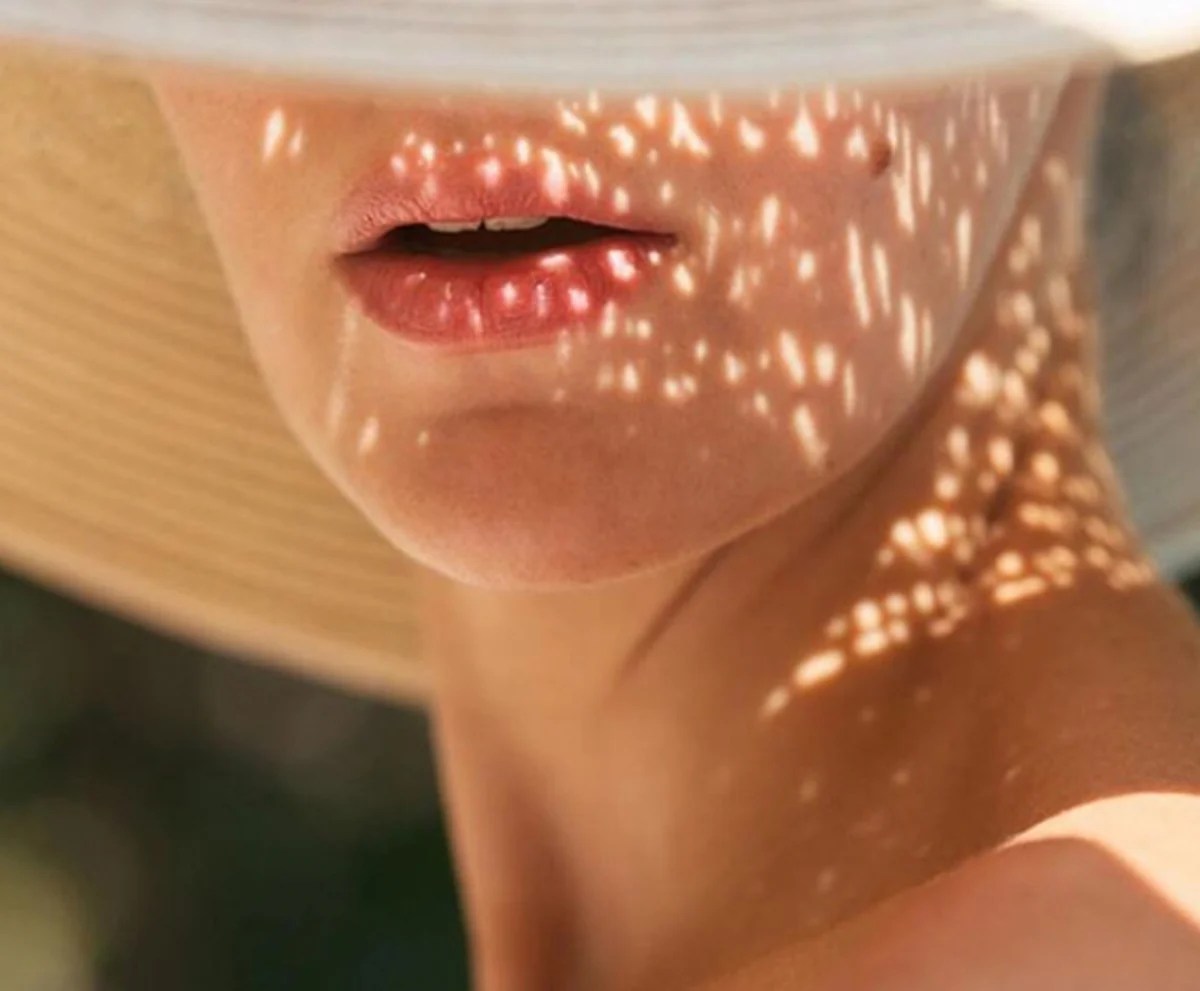 Hyperpigmentation What It Is and How to Treat It