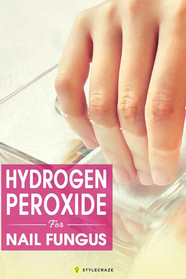Hydrogen Peroxide For Toenail Fungus Nail Fungus Vinegar Hydrogen