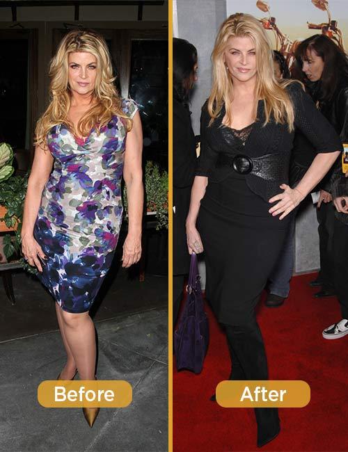 Kirstie Alley Weight Loss Lose 50 Pounds Like This Star Trek Actress