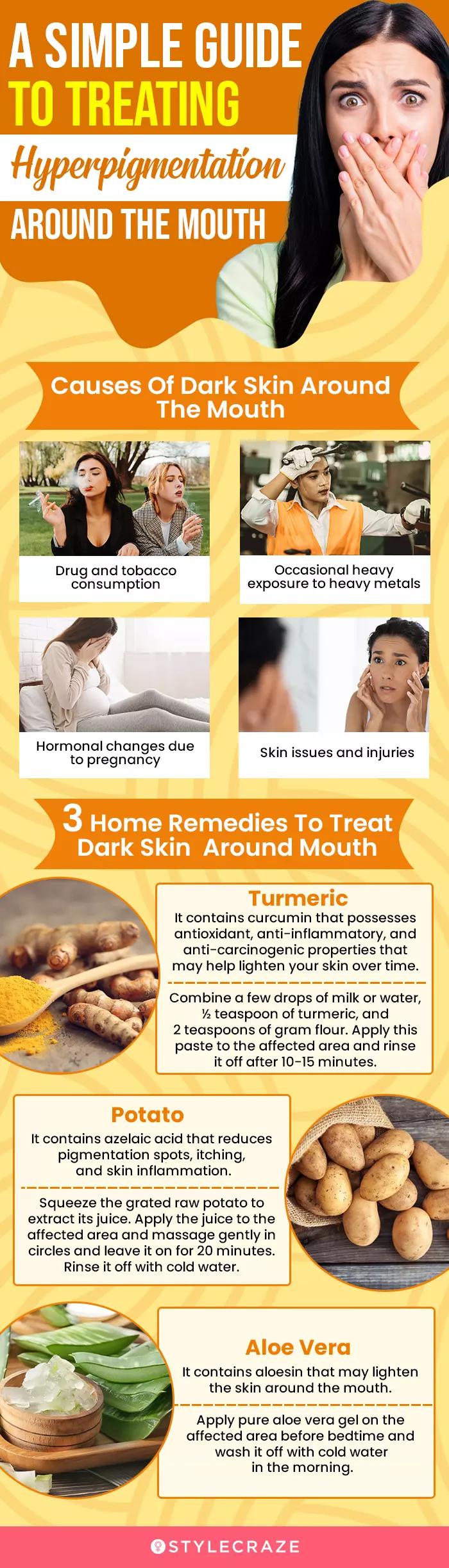 Your GoTo Guide For Treating Hyperpigmentation Around Mouth