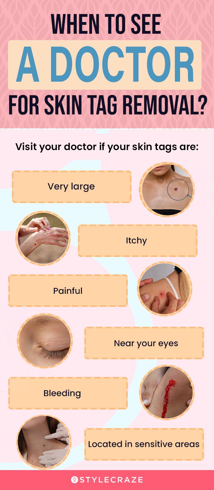 How To Use Apple Cider Vinegar For Skin Tag Removal