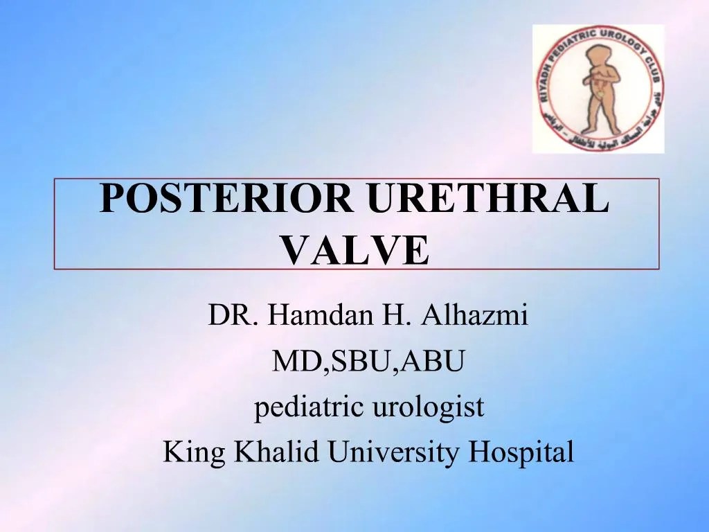 PPT POSTERIOR URETHRAL VALVE PowerPoint Presentation, free download