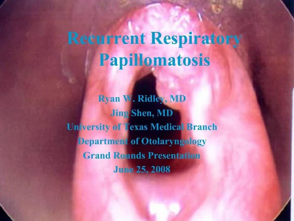 PPT Recurrent Respiratory Papillomatosis PowerPoint Presentation
