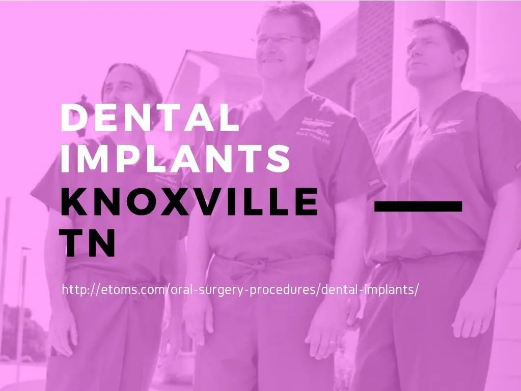 PPT Dental Implants Knoxville TN PowerPoint Presentation, free